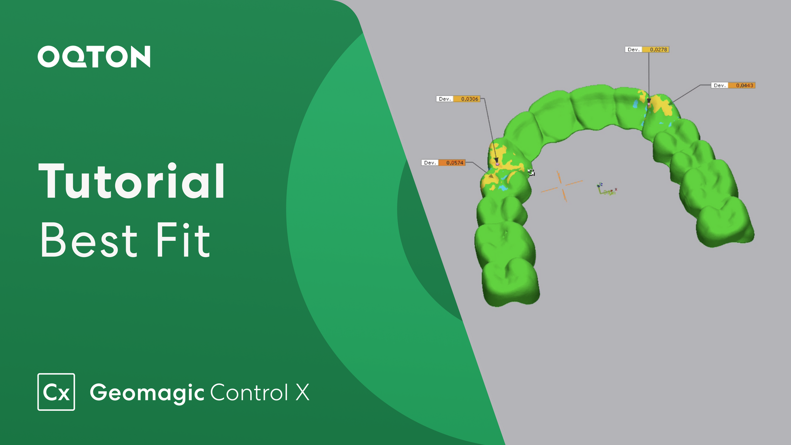 Geomagic Control X helps push orthodontic treatment forward