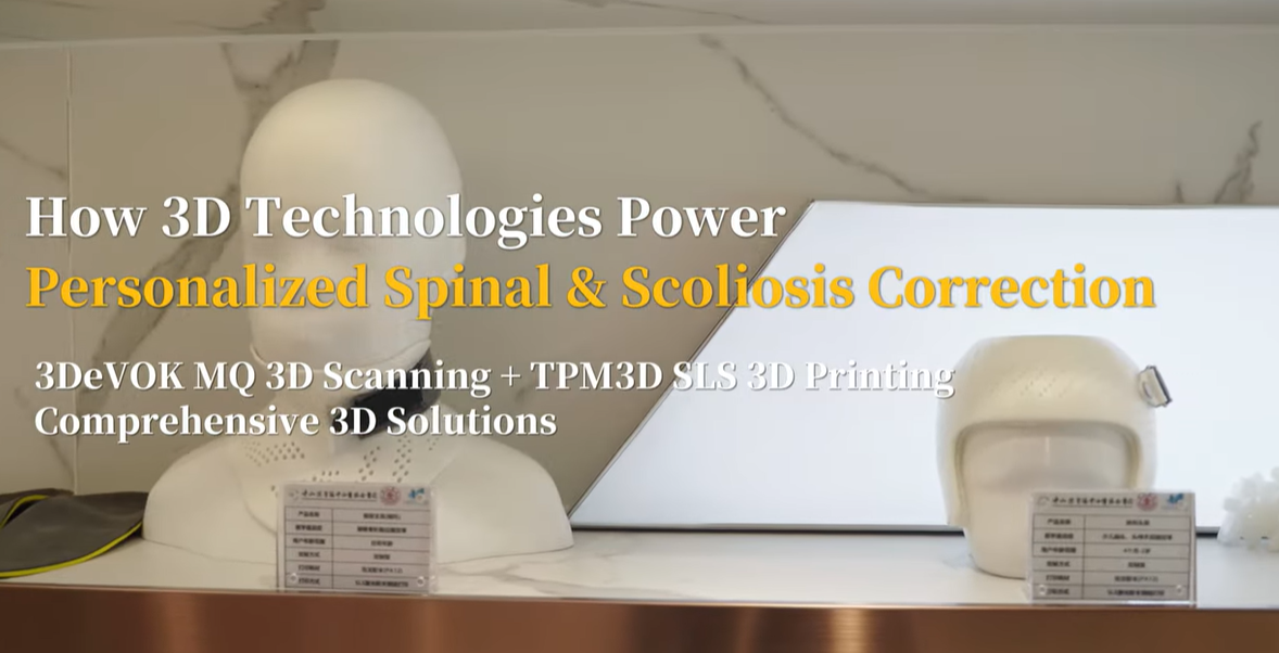3DeVOK MQ 3D Scanning + TPM3D 3D Printing: Personalized Scoliosis Correction