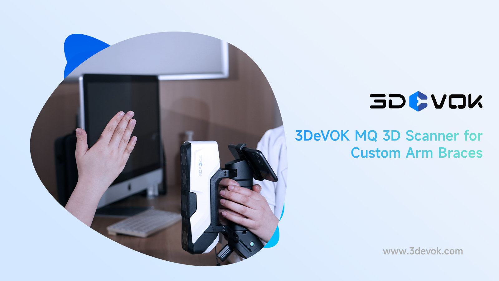 Revolutionizing Digital Healthcare with 3DeVOK MQ 3D Scanner: Precision 3D Scanning for Custom Arm Braces